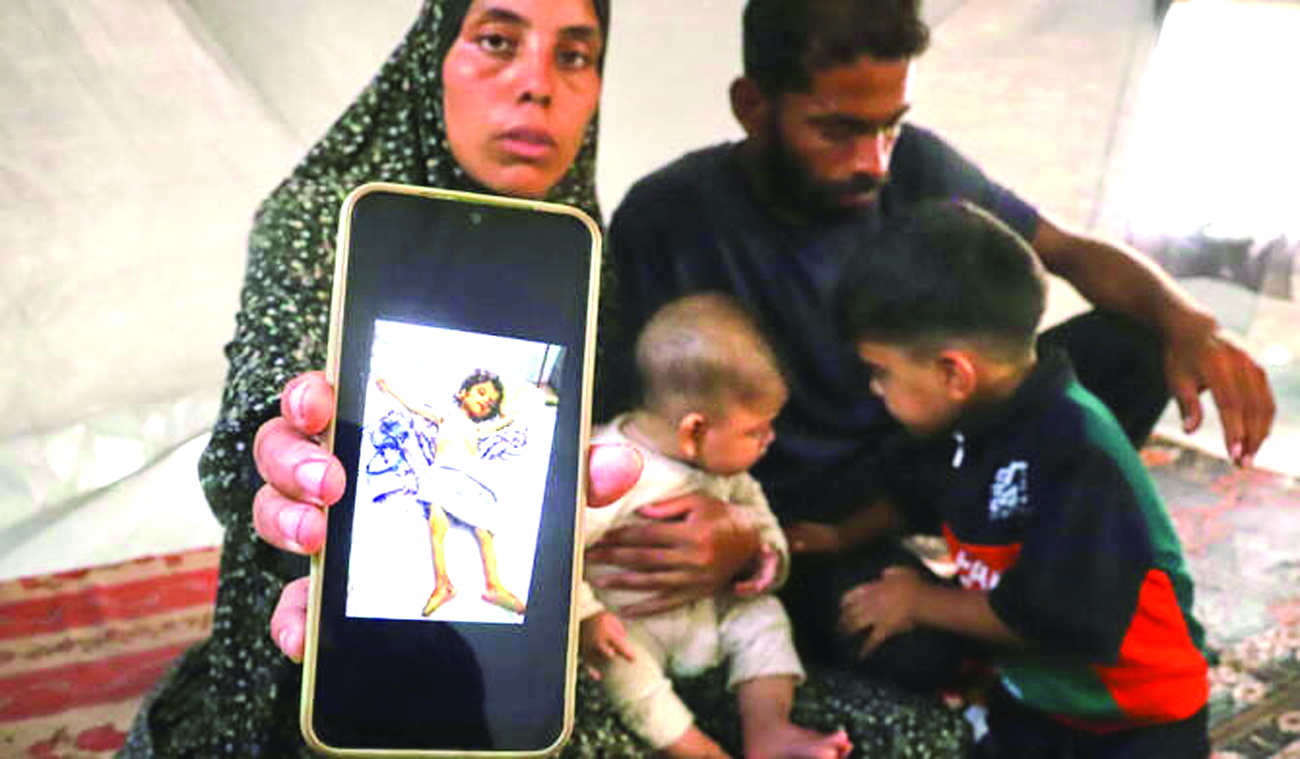 ગાઝાના હજારો બાળકો દુષ્કાળની સ્થિતિથી પીડાય છે